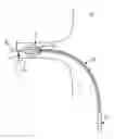 Fig. 01 - LOW-PROFILE OFF-WALL ELECTRODE DEVICE FOR RENAL NERVE ABLATION