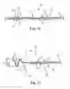 Fig. 09 - LOW-PROFILE OFF-WALL ELECTRODE DEVICE FOR RENAL NERVE ABLATION