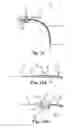Fig. 12 - LOW-PROFILE OFF-WALL ELECTRODE DEVICE FOR RENAL NERVE ABLATION