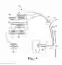 Fig. 14 - LOW-PROFILE OFF-WALL ELECTRODE DEVICE FOR RENAL NERVE ABLATION