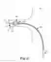 Fig. 16 - LOW-PROFILE OFF-WALL ELECTRODE DEVICE FOR RENAL NERVE ABLATION