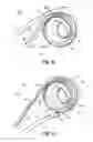 Fig. 04 - Systems, devices and methods for treating the heart with ablation