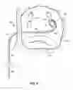 Fig. 07 - Systems, devices and methods for treating the heart with ablation