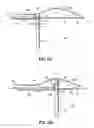 Fig. 08 - Systems, devices and methods for treating the heart with ablation