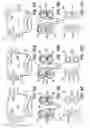Fig. 10 - Systems, devices and methods for treating the heart with ablation