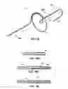 Fig. 14 - Systems, devices and methods for treating the heart with ablation