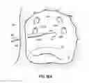 Fig. 19 - Systems, devices and methods for treating the heart with ablation