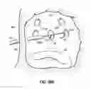 Fig. 20 - Systems, devices and methods for treating the heart with ablation