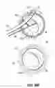 Fig. 23 - Systems, devices and methods for treating the heart with ablation