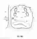Fig. 24 - Systems, devices and methods for treating the heart with ablation
