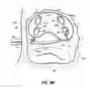 Fig. 28 - Systems, devices and methods for treating the heart with ablation