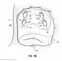 Fig. 29 - Systems, devices and methods for treating the heart with ablation