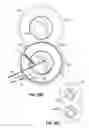 Fig. 31 - Systems, devices and methods for treating the heart with ablation