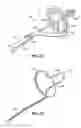 Fig. 35 - Systems, devices and methods for treating the heart with ablation