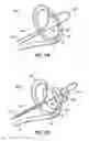 Fig. 36 - Systems, devices and methods for treating the heart with ablation