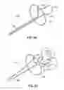 Fig. 37 - Systems, devices and methods for treating the heart with ablation