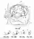Fig. 38 - Systems, devices and methods for treating the heart with ablation
