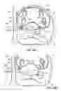 Fig. 40 - Systems, devices and methods for treating the heart with ablation
