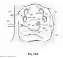 Fig. 45 - Systems, devices and methods for treating the heart with ablation