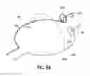 Fig. 51 - Systems, devices and methods for treating the heart with ablation