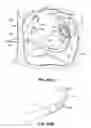 Fig. 58 - Systems, devices and methods for treating the heart with ablation