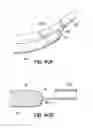 Fig. 60 - Systems, devices and methods for treating the heart with ablation