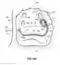 Fig. 61 - Systems, devices and methods for treating the heart with ablation