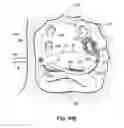 Fig. 62 - Systems, devices and methods for treating the heart with ablation