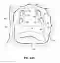 Fig. 71 - Systems, devices and methods for treating the heart with ablation