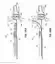 Fig. 74 - Systems, devices and methods for treating the heart with ablation