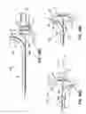 Fig. 77 - Systems, devices and methods for treating the heart with ablation