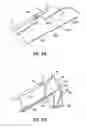 Fig. 78 - Systems, devices and methods for treating the heart with ablation