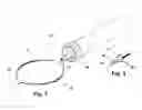 Fig. 02 - SURGICAL RETRIEVAL DEVICE RADIALLY DEPLOYABLE FROM A COLLAPSED POSITION TO A SNARE OR CAUTERIZATION LOOP