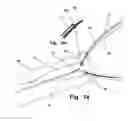 Fig. 09 - SURGICAL RETRIEVAL DEVICE RADIALLY DEPLOYABLE FROM A COLLAPSED POSITION TO A SNARE OR CAUTERIZATION LOOP