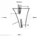 Fig. 02 - Method and apparatus for performing multidirectional tibial tubercle transfers