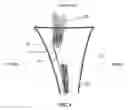 Fig. 04 - Method and apparatus for performing multidirectional tibial tubercle transfers