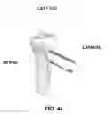 Fig. 45 - Method and apparatus for performing multidirectional tibial tubercle transfers