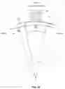 Fig. 48 - Method and apparatus for performing multidirectional tibial tubercle transfers