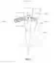 Fig. 52 - Method and apparatus for performing multidirectional tibial tubercle transfers