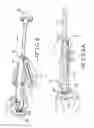 Fig. 11 - Straight cup impactor with lever arm