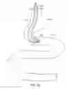 Fig. 47 - Anti-obesity devices