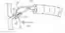 Fig. 01 - Endoscopic tissue anchor deployment