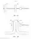Fig. 02 - Endoscopic tissue anchor deployment