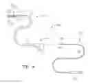 Fig. 04 - Endoscopic tissue anchor deployment