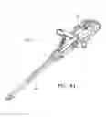Fig. 07 - Endoscopic tissue anchor deployment