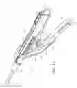 Fig. 10 - Endoscopic tissue anchor deployment