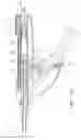 Fig. 11 - Endoscopic tissue anchor deployment