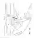 Fig. 12 - Endoscopic tissue anchor deployment