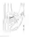 Fig. 13 - Endoscopic tissue anchor deployment