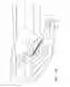 Fig. 16 - Endoscopic tissue anchor deployment